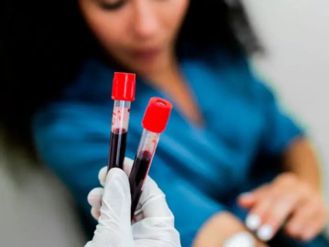 50 növ xərçəngi aşkarlayan qan testindən ümidverici NƏTİCƏ