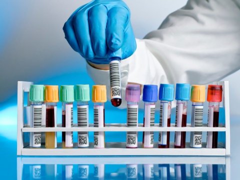 Qan analizi ilə 50 növ xərçəng aşkarlanacaq