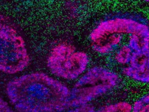 Alimlərdən ilk - Beyin atlası tərtib etdilər