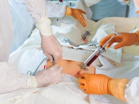 Sümük iliyi köçürməsi tibbi sığorta ilə mümkün olacaq