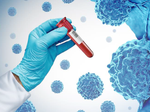 Bu xəstəliklərin diaqnostikası icbari tibbi sığortaya daxil edildi