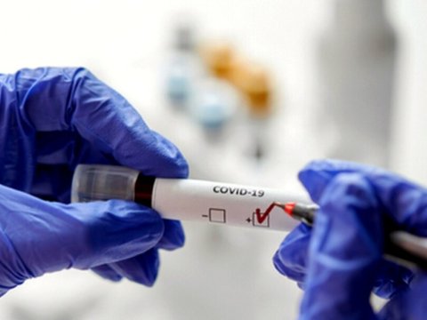 Azərbaycanda COVİD-19-a yoluxanlar var - RƏSMİ