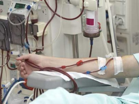 Azərbaycanda 4000-dən çox hemodializ xəstəsi var