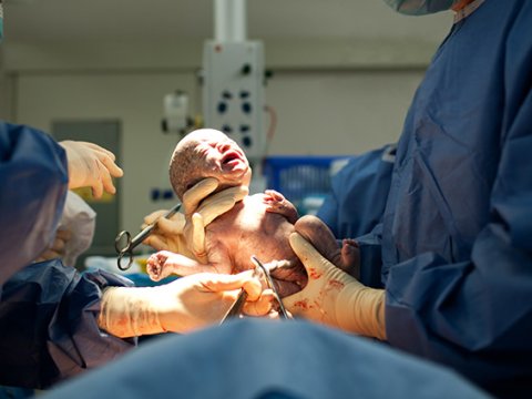 &ldquo;Qeysəriyyə əməliyyatlarının sayı 10 faizədək azalıb&rdquo;&nbsp;