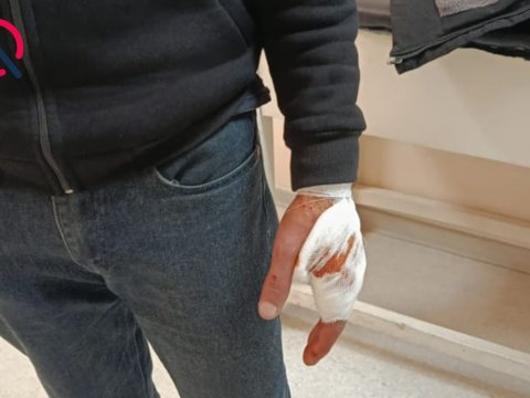 Şəkidə canavar kəndə hücum etdi - Xəsarət alanlar var