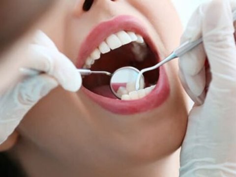 Azərbaycanda 74 stomatoloq qanunsuz fəaliyyət göstərirmiş