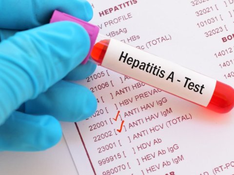 Azerbaycan'da hepatit enfeksiyonu 30 kattan fazla azaldı