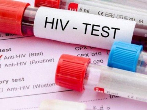 Azərbaycanda 1287 nəfər&nbsp;QİÇS-ə yoluxub