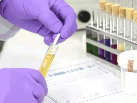 Narkoloji xəstələrlə bağlı işə qəbul qaydaları sərtləşdirilir