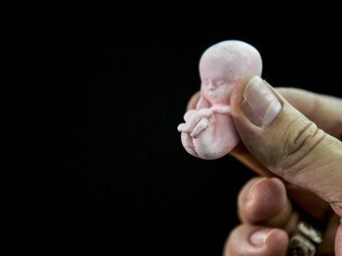 Azərbaycanda abortların sayı rekord həddə çatıb