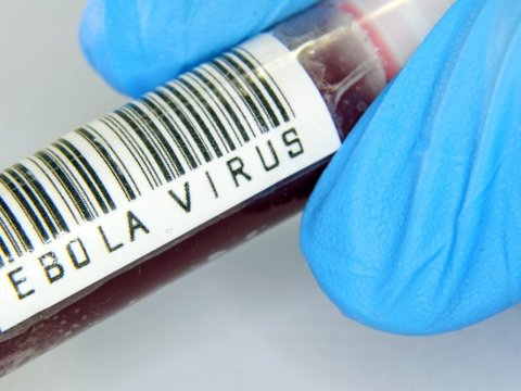 ÜST: Ebola virusu sürətlə yayılır