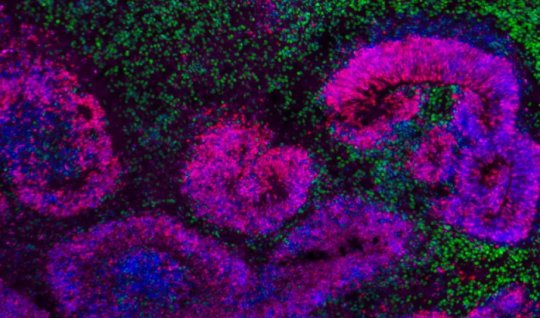 Scientists were the first - They compiled a brain atlas