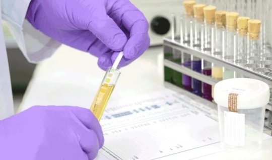 Narkoloji xəstələrlə bağlı işə qəbul qaydaları sərtləşdirilir