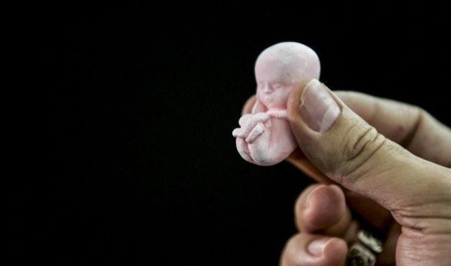 Azərbaycanda abortların sayı rekord həddə çatıb