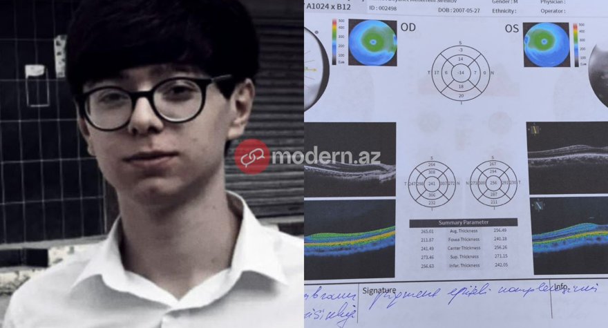 Modern.az-ın yazısına reaksiya: Görmə qüsurlu çağırışçı təkrar müayinəyə göndərildi