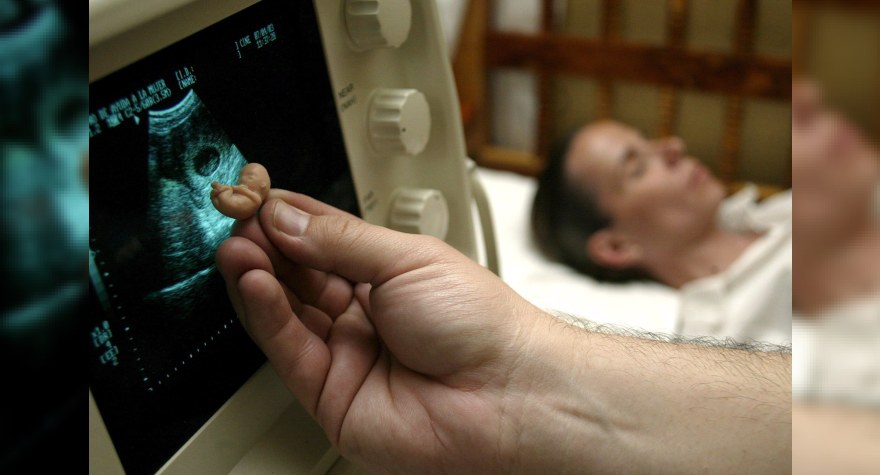 Azərbaycanda abortlar ən çox bu yaşda edilir - STATİSTİKA