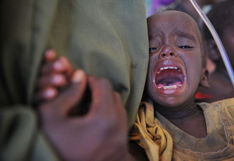 Somalidə inanılmaz aclıq görüntüləri (FOTOLAR)