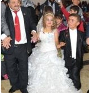  Yeni nəslin cırtdanlaşmasının səbəbləri - MÜTƏXƏSSİS RƏYİ