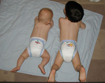 Azərbaycan həkimləri həyəcan təbili çalırlar - "Pampers" allergiya mənbəyidir
