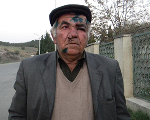 Gürcüstanda azərbaycanlı ailəyə silahlı dəstənin basqını  - FOTOLAR