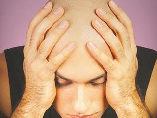 Saç tökülməsinin səbəbləri - Kişilərin və qadınların PROBLEMİ