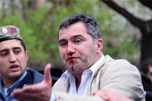  Sərkisyan İrəvanda müxalifətə divan tutdu - FOTOLAR