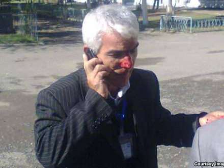 Beyləqanda müşahidəçi döyüldü - FOTO
