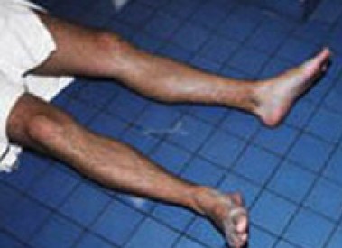 Dəm qazı ölümü - Niyə yayda deyil qışda? - ARAŞDIRMA 
