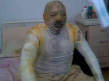 AHİK özünü yandıran Qarabağ əlilinin ailəsini himayəyə götürdü - QƏRAR