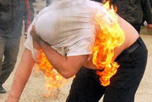 “Özünüzü yandırmayın” - Qarabağ qaziləri cəbhə yoldaşlarına müraciət etdi