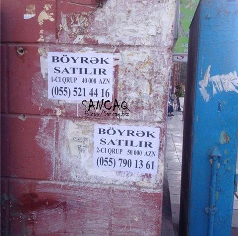 Bakıda böyrək satışı - açıq elan - FOTO
