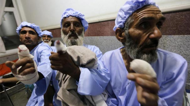 Taliban səs verənlərin barmaqlarını kəsdi 