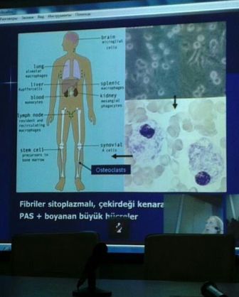 ATU-da Türkiyə tibb mərkəzləri ilə telekonfrans keçirilib - FOTO