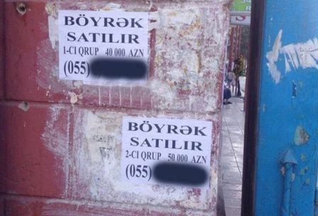 Orqan satışı ilə bağlı elan verən şəxslər həbs olunub