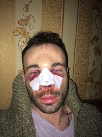 Jurnalist vəhşicəsinə döyüldü - FOTO