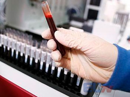 Azərbaycanda talassemiya xəstəliyinin ən çox yayıldığı RAYONLAR
