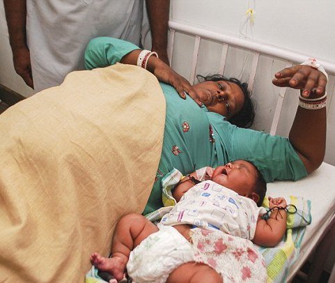 6 kiloqramlıq uşaq doğuldu - FOTO