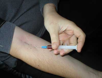 Azərbaycanda hansı məktəblərin şagirdləri narkotikdən istifadə edir? - AÇIQLAMA