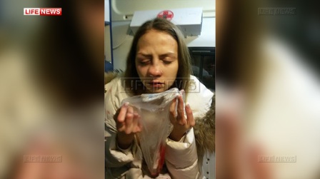 Xanım jurnalist pərəstişkarı tərəfindən ölümcül döyüldü - FOTO