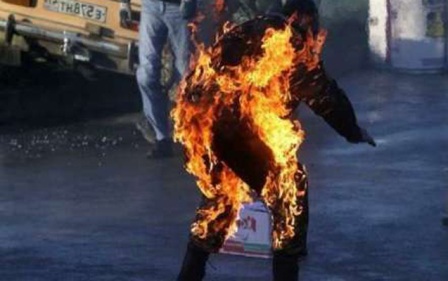 Sərxoş vəziyyətdə özünü yandırdı – Bakıda 
