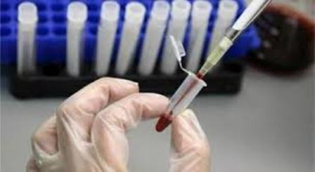  Nazirlər Kabinetinin qərarı ləğv edilib 