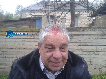   Cəbhə bölgəsinə yollanan QAT üzvü başından yaralanıb