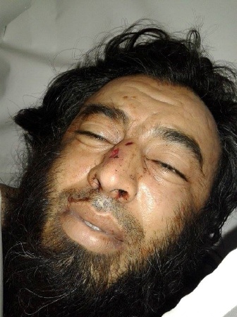 Suriyada daha bir azərbaycanlı öldürüldü – FOTO