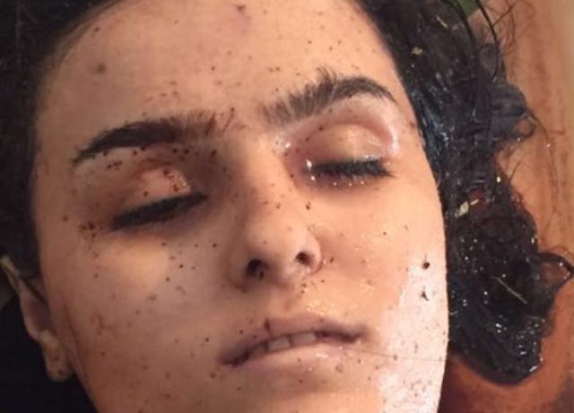 Azərbaycan polisi bu meyitin kimliyini axtarır - FOTO  