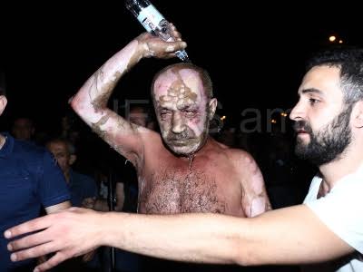 Yerevanda mitinq iştirakçısı özünü yandırdı - FOTOLAR