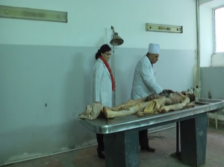 Meyit orqanlarının transplantasiyası etik məsələdir - A&Ccedil;IQLAMA