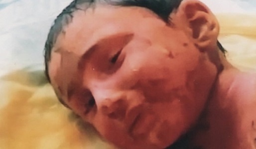 Yevlaxda həkim səhvi uşağı &ouml;l&uuml;mc&uuml;l hala salıb - Video 