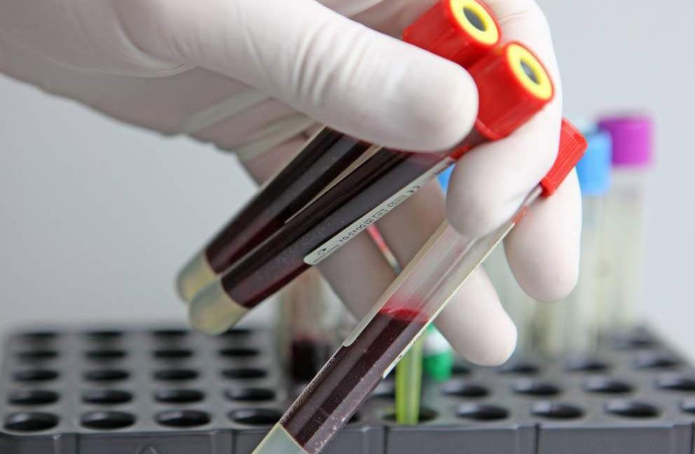  Qriplə bağlı son statistika a&ccedil;ıqlandı - 10 nəfərdə H3N2 virusu tapıldı 