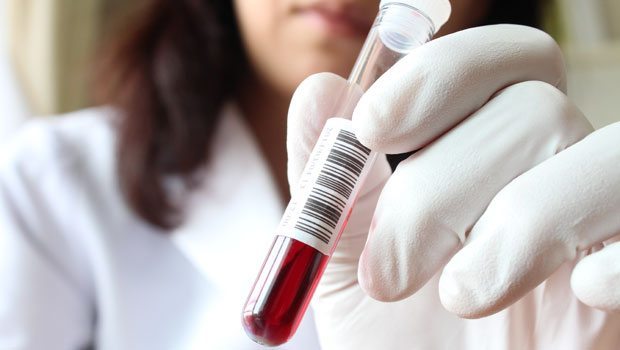 4122 hepatitli xəstə dövlət hesabına müalicə alır   