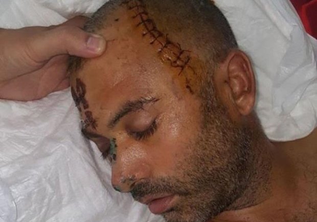 Müğənni İzzət Bağırovun “beşbarmaq”la adam vuran işçisi niyə azadlığa buraxıldı? - FOTO   